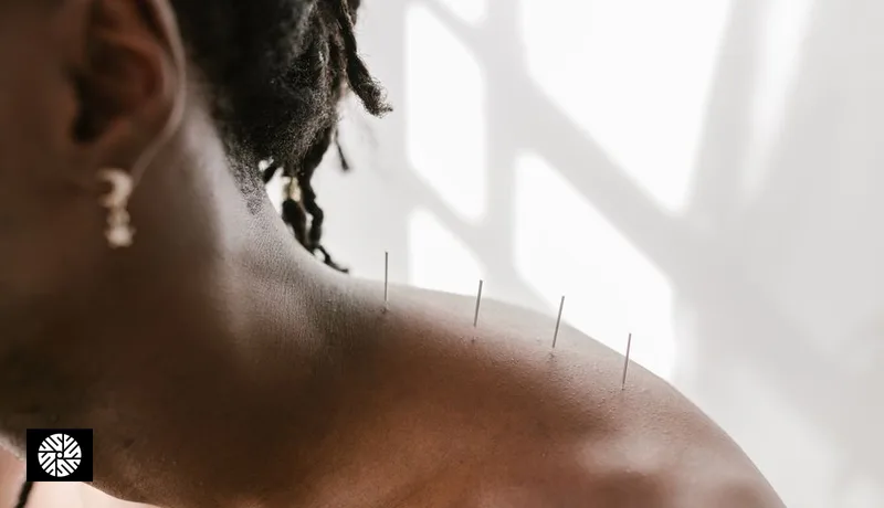 How to Try Traditional Chinese Medicine in Taiwan: Acupuncture, Tui-Na & What to Expect - Health information for international visitors in Taiwan