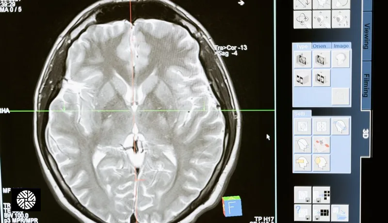 Brain MRI Cost: What It Runs in the US, and What You Get in Taiwan