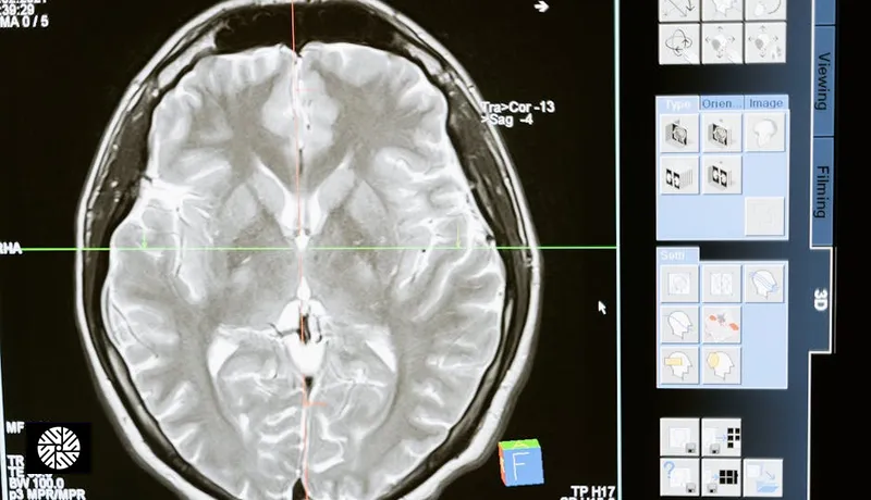 Brain MRI in Taiwan – Advanced Imaging for Longevity and Performance