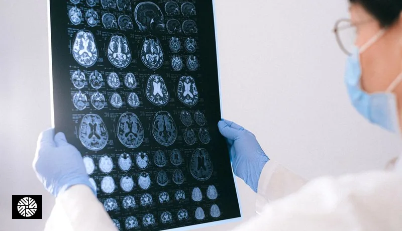 Visceral Fat and the Brain: What Midlife MRI Studies Show