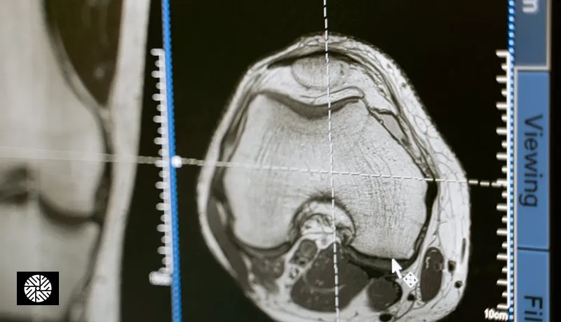 Why Many Americans Now Fly to Taiwan for Full-Body MRI - Health information for international visitors in Taiwan
