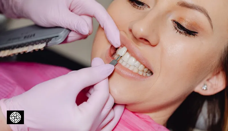 Veneers and Crowns in Taiwan: A Complete Guide for Medical Travelers