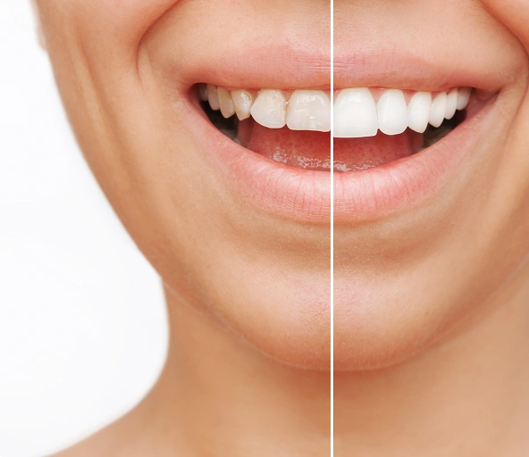 Image showing dental treatment tools or smiling patient
