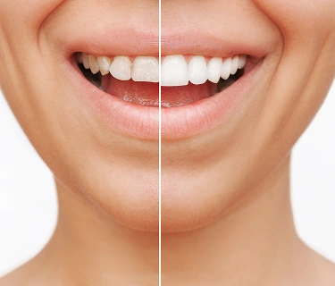 Image showing dental treatment tools or smiling patient