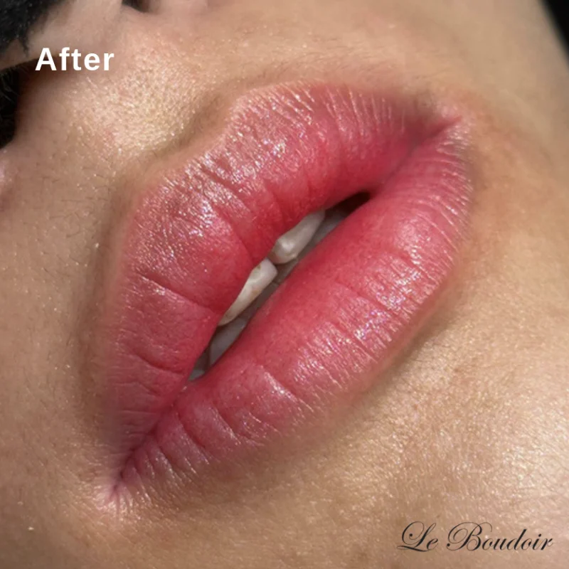 Le Boudoir — clinic photo 5